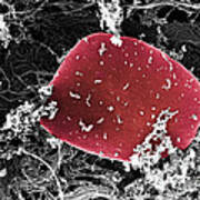 Blood Platelets, Sem Poster