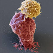 Leukemia Cell With Car T-cell, Sem #1 Poster