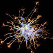 Neurons From Stem Cells Poster
