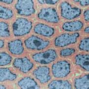 Epithelial Cells Poster