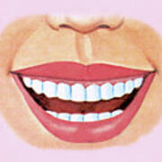 Smiling Mouth Showing Teeth Poster