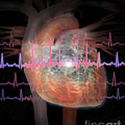 Heart With An Erratic Ekg #1 Art Print