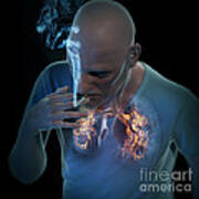 Dangers Of Smoking #2 Art Print
