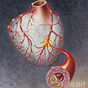 Arteries On Heart Showing Art Print