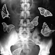 Butterflies In The Stomach Art Print