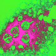 Coloured Tem Of Hepatitis B Virus Particles Art Print