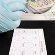 E. Coli Stec Bacterial Test Art Print