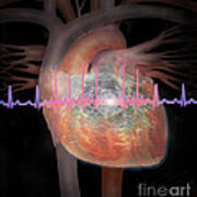 Heart With An Erratic Ekg Art Print