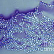 Lm Of Cryptococcus Albidus Art Print