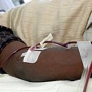 Man Donates Blood Platelets Art Print
