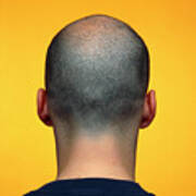 Rear View Of A Male Head With Very Short Hair. by Alex Bartel/science Photo  Library