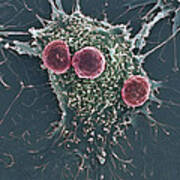 T Lymphocytes And Cancer Cell, Sem #3 Art Print