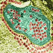 Herpes Simplex Virus, Tem #7 Art Print