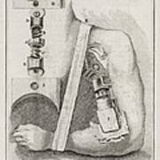 Bone-setting Mechanism, 18th Century Art Print