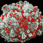 Coloured Sem Of T-cell Infected With Aids Viruses Art Print