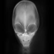 Alien X-ray Art Print