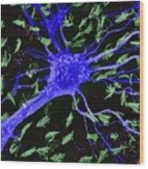 Astrocytic Glial Cell From Cns #1 Wood Print