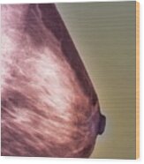 Normal Mammogram #1 Wood Print
