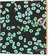 Ovalocytosis Lm #1 Wood Print