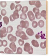 Red Blood Cells And Platelets #1 Wood Print