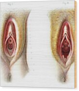 Virgin And Non-virgin Vulva Anatomy #1 Wood Print