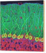Purkinje Nerve Cells In The Cerebellum Wood Print