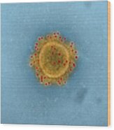 Mers Coronavirus Particles, Tem #3 Wood Print