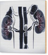 Kidneys And Adrenal Glands #4 Wood Print