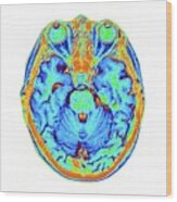 Coloured Mri Scan Of The Human Head #8 Wood Print