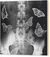 Butterflies In The Stomach Wood Print