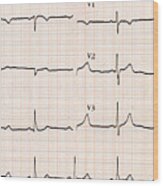 Cardiogram Chart (ecg) Wood Print