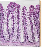 Colon Mucosa Lm Wood Print