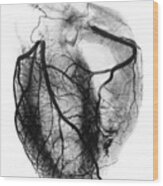 Coronary Arteriogram Of Arteries Of The Heart 1904 Wood Print