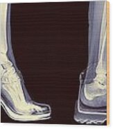 Different Shoes X-ray Wood Print