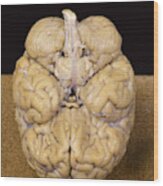 Human Brain Inferior View Framed Print