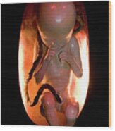 Human Foetus Wood Print