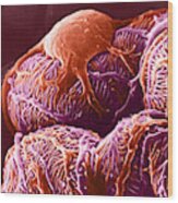 Kidney Glomerulus, Sem Wood Print