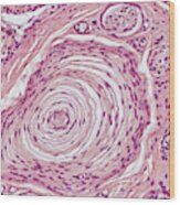 Pacinian Corpuscle Lm Wood Print