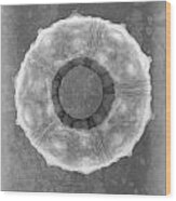 Sputnik Sea Urchin X-ray Art Wood Print