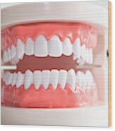 Teeth And Dental Instrument Wood Print