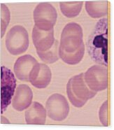 Two White Blood Cells Or Leukocytes--neutrophil (right) And Eosinophil (left), Human Blood Smear, 500x Wood Print