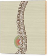 Lower Back Pain #1 Wood Print