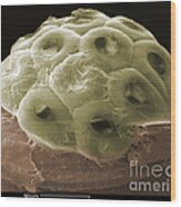 Sem Of A Head Lice Eggs #1 Wood Print