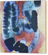 Healthy Large Intestine, Barium X-ray #2 Wood Print