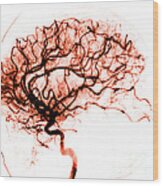 Cerebral Angiogram Wood Print
