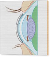 Cross Section Biomedical Illustration Of Soft Contact Lens On Eye Wood Print