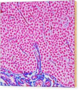 Parathyroid Gland Ts Wood Print