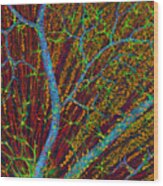 Retina Blood Vessels And Nerve Cells #1 Wood Print