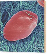Blood Platelets, Sem #3 Wood Print