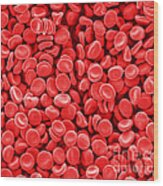Red Blood Cells, Sem #4 Wood Print